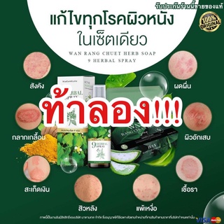 ส่งฟรี! โปร 6แถม1 สเปรย์รักษาสังคัง กลากเกลื้อน สะเก็ดเงิน เชื้อรา อาการคันต่างๆ เชื้อราหนังศรีษะ สมุนไพรแท้