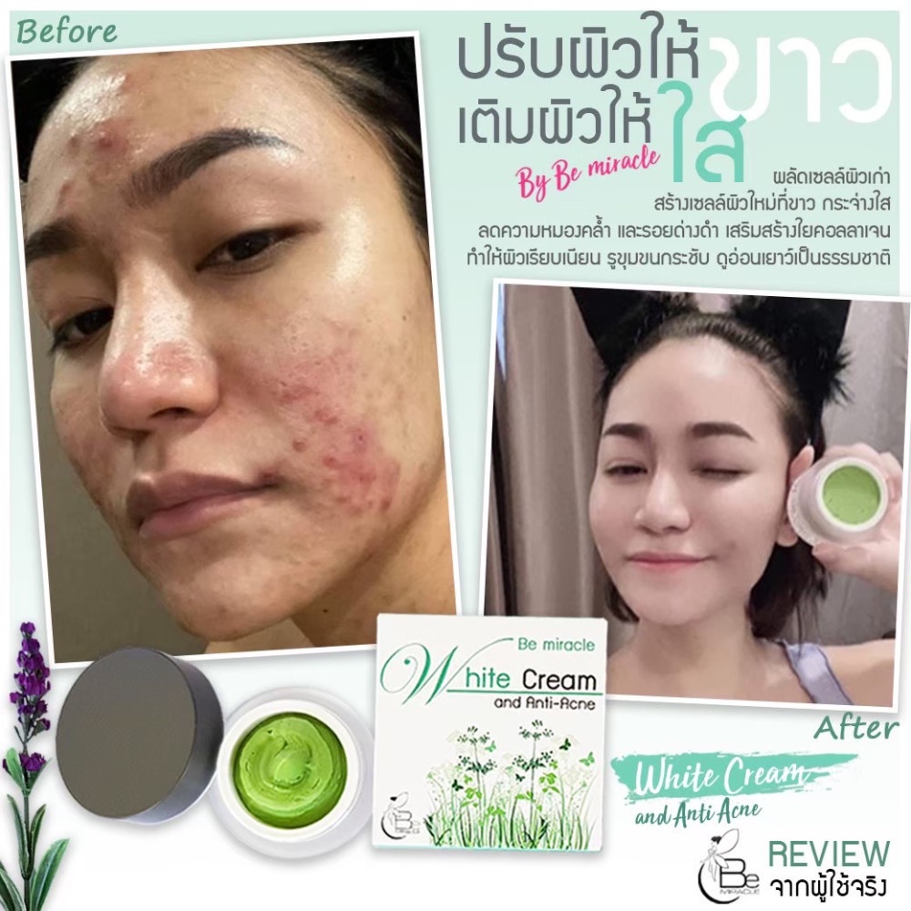 ครีมบีมิราเคิล (Bemiracle cream) ครีมเขียวรักษาสิวทุกชนิด ลดรอยด่างดำ หน้าขาวกระจ่างใส ราคา ถูกที่สุด ดีลบีเคเค แกลเลอรีภาพที่ 2
