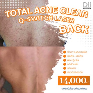 Dii Aesthetic : Total Acne Clear + Q-Switch Laser (Back) 1 Time