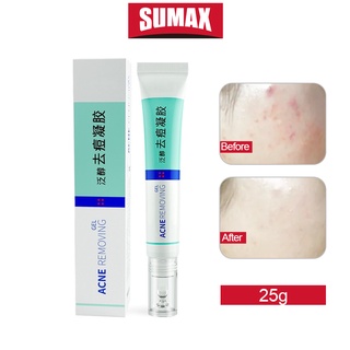 Sumax ครีมแต้มสิว ลดสิว ป้องกันรอยคล้ํา รอยแผลเป็นจางลง ดูแลผิว 25 กรัม