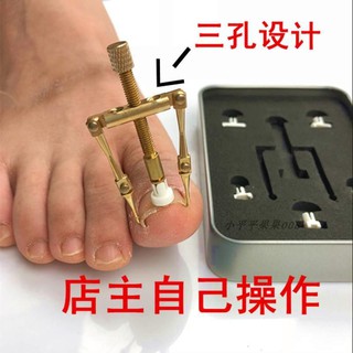 ✟♟™เล็บคุด แก้ไขเล็บคุด ดัดผมเล็บเท้า เครื่องมือพิเศษ Yan nail groove nail clippers orthopedic nail sticking nail