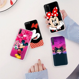 Ml-187 เคสโทรศัพท์มือถือแบบนิ่ม ใส ลายมิกกี้เมาส์ สําหรับ VIVO Y22s Y16 Y02S Y02 Y01 V25 V25E X80 Pro