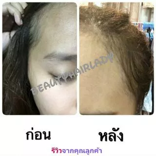 🔥ค่าส่งถูก+แท้🐌 Genive Hair Tonic 120ml มีอย. ลดผมร่วง ปลูกผม ขจัดรังแค แก้คัน จีนิวี แฮร์ โทนิค Spray บำรุงรากผม