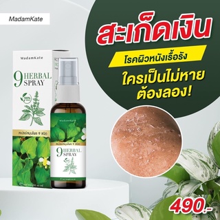 ส่งฟรี ✅ ขสเปรย์สมุนไพร สเปรย์ฉีดกลากเกลื้อน คันเรื้อรัง สะเก็ดเงิน สะเก็ดทอง กลากเกลื้อน เชื้อรา ผื่นแพ้ คันลมพิษ