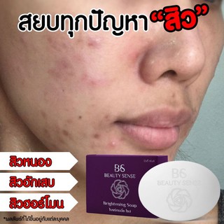 ฺสบู่ลดสิว ผิวติดสาร บิวตี้เซ้นส์ (Beauty Sense) ปลอดภัย ไร้สารสเตียรอยด์  ลดสิวหนอง สิวอักเสบ