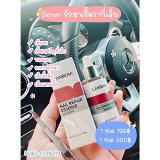 Serum รักษาเชื้อราที่เล็บ  -เล็บขบ -เชื้อราต่างๆที่เล็บ -บวมแดง -อากาอักเสบ -เล็บมีกลิ่น -เล็บแทงเนื้อ