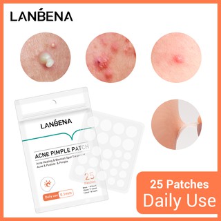 Lanbena แผ่นแปะสิว รักษาสิว เพื่อความงาม 25 ชิ้น