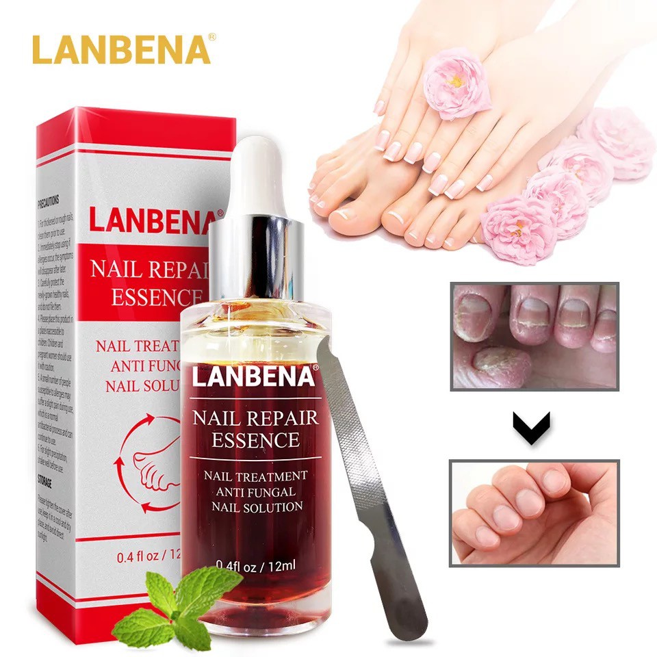 LANBENA เอสเซ้นส์ซ่อมแซมเล็บ Fungal Nail Treatment ลบ Onychomycosis Toe Nourishing Brighten Hand Foot Skin Care