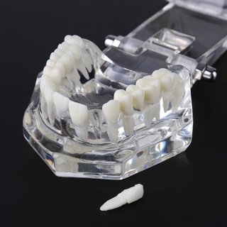 【ddydental】โมเดลฟัน อุปกรณ์ทันตกรรม สําหรับทันตกรรม