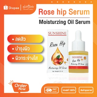 [ลดเพิ่มโค้ดน้ำมันกุหลาบป่า เซรั่ม Rose Hip Oil Serum เพื่อผิวหน้าชุ่มชื่น กระจ่างใส ลดสิว ยกกระชับผิวหน้า กระชับรูขุมขน