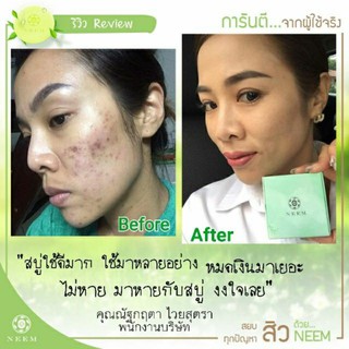 Neem Bright &amp; Clear Acne Soap สบู่ออร์แกนิค สบู่นีม สบู่รักษาสิว สบู่สิวหลุด neem natural