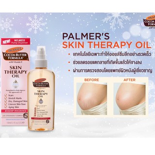 🌴หมดอายุ01/22 ลดรอยแตกลาย ท้องลายจากการขยายผิว** Palmer s Cocoa Butter Formula Skin Therapy Oil 60 ml พรีเมียมออยล์