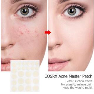 Korea Acne Pimple Master 24 patches skincare Acne remover