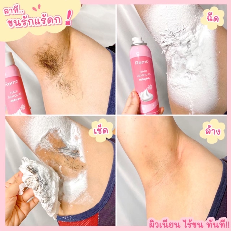 [บริษัทโดยตรง] มูสกำจัดขน รีโม่ Remo Hair Removal mousse สเปรย์กำจัดขน