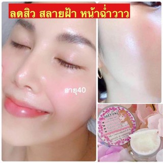 ครีมหน้าวิ้งค์ ครีมหร้าขาว ลดสิว ฝ้า กระ จุดด่างดำ สูตรใหม่