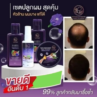 พรทิน่า แชมพู ครีมนวด สเปรย์ปลูกผม แชมพูกำจัดเหา ของแท้ มีเก็บเงินปลายทาง