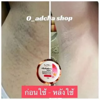 ครีมทารักแร้ขาวโออัจชา 30g