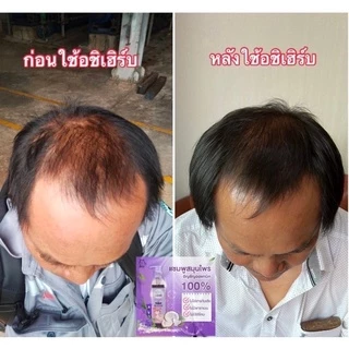 Achi Herb ออแกนิค แชมพูเร่งผมยาวสำหรับเด็ก และผู้ใหญ่ ผมยาวไวx3 ใช้ได้ตั้งแต่แรกเกิด