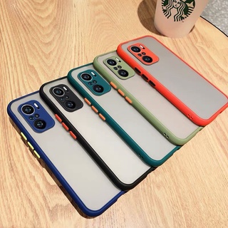 ส่งจากไทย เคสมือถือXiaomi Redmi Note10 4G/5G เคสเสี่ยวมี่ เรดมี โน๊ต10 TPU CASE เคสกันกระแทก กันรอยกล้อง ขอบนิ่มหลังแข็ง