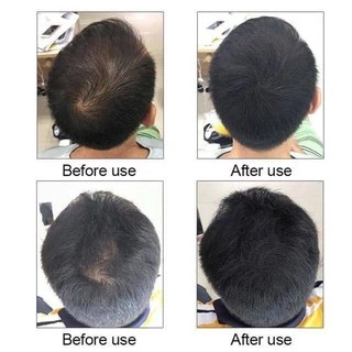 Kingyes Hair Spray สเปรย์ผม ไฟเบอร์ ปิดผมบาง ผมขาว แก้ปัญหาหัวล้าน 130 ml