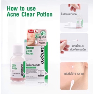 โพชั่นแต้มสิว สูตรใหม่จากญี่ปุ่น Oxe Cure  Clear Potion 15 ml. ของแท้ จัดส่งไว มีเก็บปลายทาง