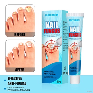 Nail Fungus Removal Cream Nail Care Ointment Anti-infection For Toenails Antibacterial Infection Repair Ointment Feet Ca