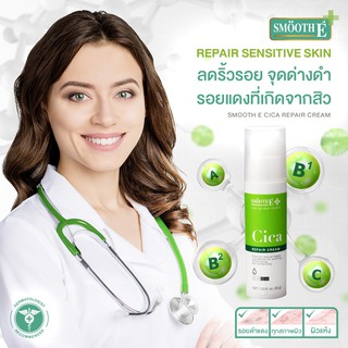 **แถมฟรีเจลล้างมือSmooth e Smooth E Cica Repair Cream 35g