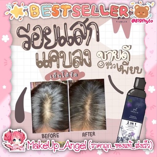 🌈(ของแท้💯-พร้อมส่ง)🌷 แชมพูวาริส ลดผมร่วง (shampoo varlis) แชมพูอัญชัน