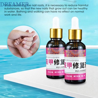 【Dreamer】เซรั่มบํารุงเล็บเท้าป้องกันแบคทีเรียป้องกันเชื้อรา 30 มล.