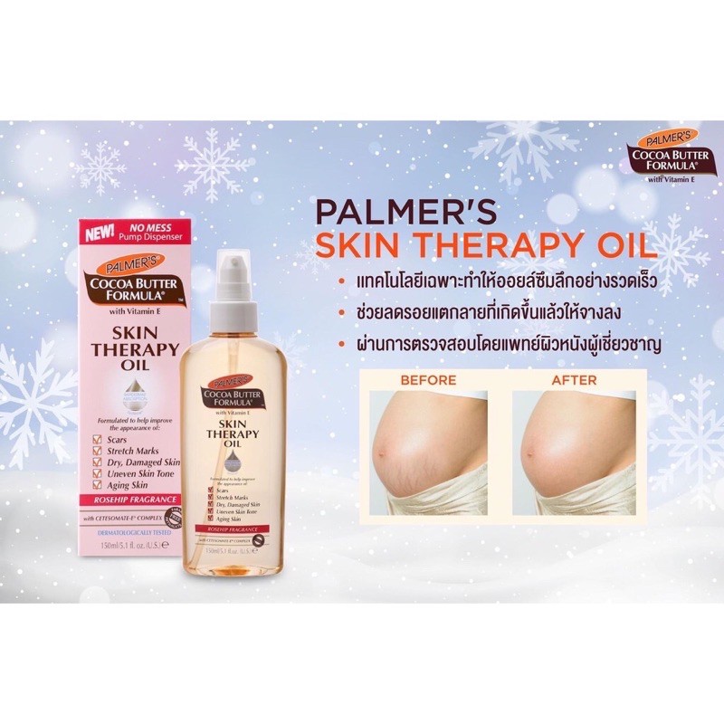 ของแท้แน่นอน100% พร้อมส่ง Palmer’s skin therapy oil (Rosehip) ขวดใหญ่ 150ml