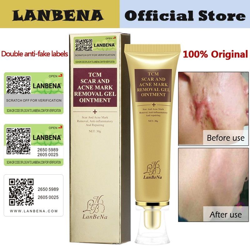 LANBENA Acne Scar Removal Cream Skin Repair Face Cream ครีมกำจัดรอยแผลเป็นจากสิวครีมซ่อมแซมผิวหน้า