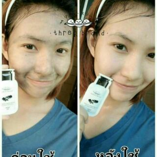 นาทีนี้ไม่มีใครไม่รู้จัก Detox Threebrand
💥ถูกและดีมีในโลก 45 บาท กำจัดสิวได้ทุกชนิด!!! ❥ดีท็อกซ์ทร