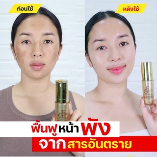 (สุดยอด📌ส่งไวมาก)แฟรี่โกลด์ครีม&amp;เซรั่มส่งของทุกวันกู้หน้าพังดีขึ้นลุ้นทองทุกกล่อง