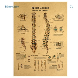 Bittercoffee Hot Sale The Human Body Spinal คอลัมน์ Hd โปสเตอร์กระดาษสําหรับตกแต่งบ้าน