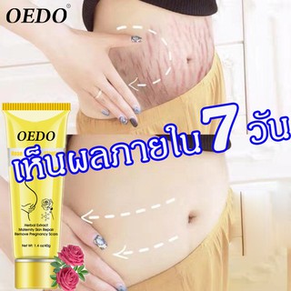 สูตรธรรมชาติบริสุทธิ์ ครีมท้องแตกลาย  เป็นคุณแม่ดูเซ็กซี่ไร้รอยแตกลาย! (ครีมทาท้องลาย ครีมแก้ท้องลาย ครีมหน้าท้องแตกลาย）