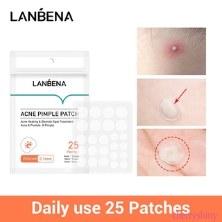 Lanbena แผ่นสติ๊กเกอร์แปะสิว 25 ชิ้น Nicey