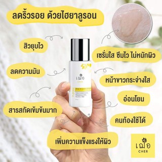 🌿เฌอ T-ZONE เซรั่มลดสิว สำหรับผิวมัน CHER Acne oil control for T-zone Serum (Oil Free) สินค้าพร้อมส่ง!