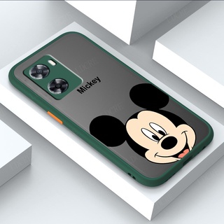 Oppo A57 4G 2022 A77 5G ไฮบริด ซิลิโคน TPU นิ่ม + ฝาหลังแข็ง มิกกี้เมาส์ ผิวสัมผัส ยาง เคส