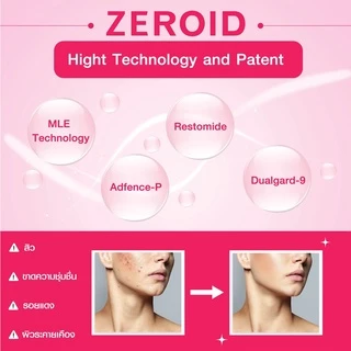 ซีรอย Zeroid Pimprove Toner 200ml โทนเนอร์เคลียร์ผิวหมอง คุมมัน ไร้สิว
