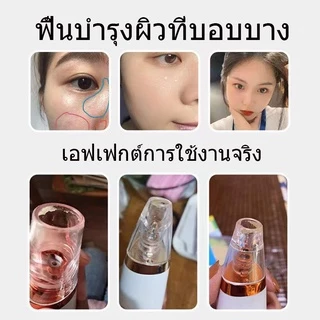 🔥 พร้อมส่ง 🔥เครื่องดูดสิว ที่ดูดสิวเสี้ยน สิวข้างจมูก ดูดสิวเสี้ยนอุดตันลบรอยจุดดำจากสิวเสี้ยนที่จมูก เครื่องดูดสิวไฟฟ้า