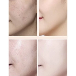 N036 รองพื้นบีบีครีมมี่คอนซีลเลอร์ ปกปิดรอยสิว รอยแดง จุดด่างดําและใต้ตาดํา