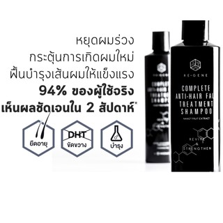 รีจีน Regene แชมพูสำหรับลดผมร่วง หัวล้าน ผมบาง เห็นผลจริง