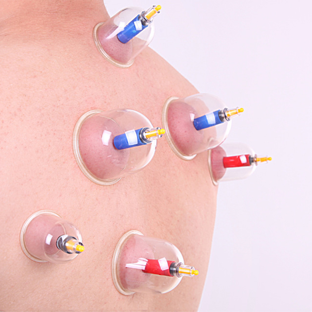 Please COD 1 set 12/24pcs Vacuum Cupping Cups Suction Therapy Device ...