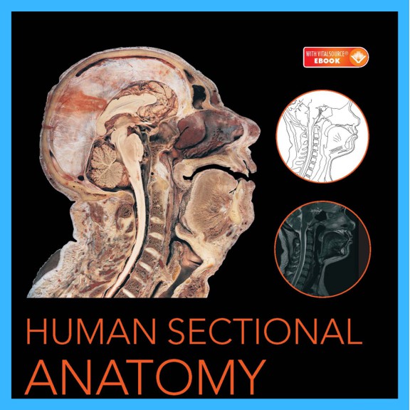 Human Sectional Anatomy Atlas of Body ส่วน ภาพ CT และ MRI รุ่นที่สี่
