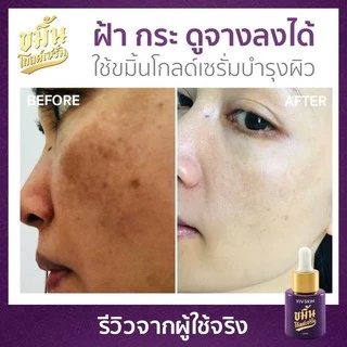 🔥โปรเซ็ต 4 ชิ้น‼️ ของแท้💯 VIV SKIN เซ็ตขมิ้น สูตร ORIGINAL (เซรั่ม + ครีม) วิฟสกิน ครีมจุ๋ย