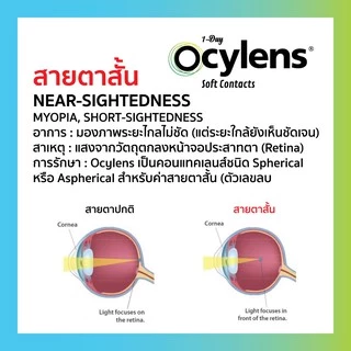 Ocylens สายตาสั้น โปร 1 กล่อง 30 คอนแทคเลนส์ รายวัน ชนิดใส