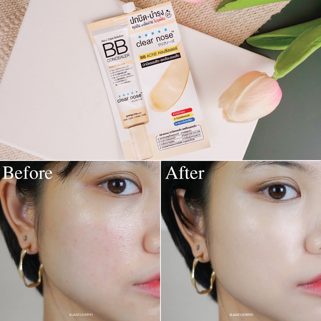 ยกกล่อง (6ซอง) Clear Nose Acne Care Solution BB Concealer เคลียร์โนส แอคเน่ โซลูชั่น บีบี คอนซีลเลอร์