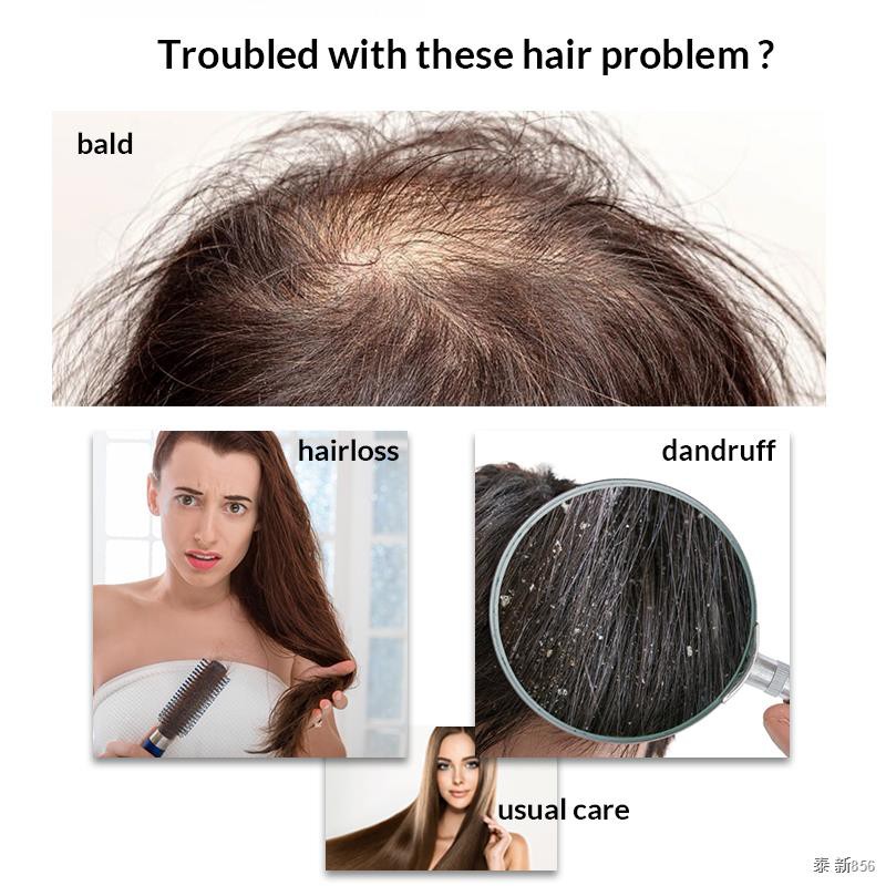 OMY LADY Ginger Anti Hair Loss Shampoo promote hair growth Shampoo Hair  Thick Fast Growth Serum Herbal Liquid For Women | Shopee Thailand