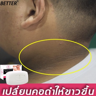 BETTER สบู่ไวท์เทนนิ่ง100g สบู่เร่งผิวขาว ล้างจุดซ่อน ทำให้เมลานินจางลง สบู่เร่งผิวขาว บำรุงผิวขาวกระจ่างเนียนใส