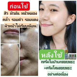 เซรั่มใบบัวบก​ เซรั่มรักษาสิว​ ครีมวิตามิน​โสม​ เซตหน้าเด็ก​